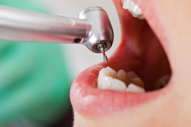 Best Weekend Emergency Dentist in Sturgis, MI